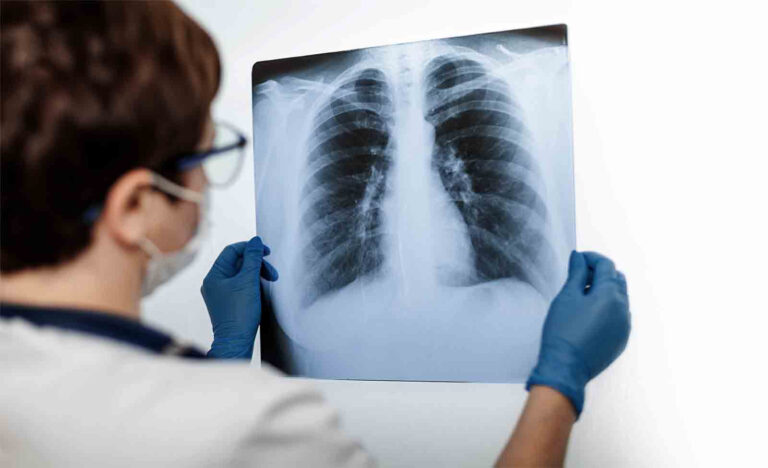 Se realizó la primera tromboaspiración pulmonar del Nordeste en el Parque de la Salud