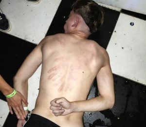 Denuncian que un joven fue golpeado por policías en servicio adicional en un boliche de Posadas