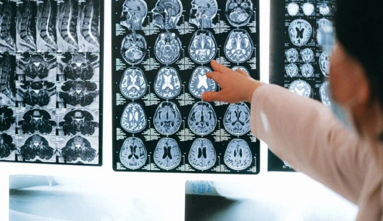 Misiones tendrá una jornada de concientización sobre encefalitis autoinmune con una especialista del Garrahan